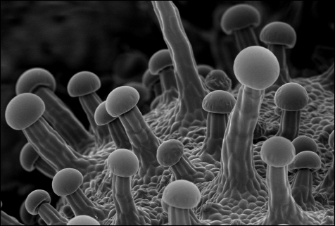 Cannabis trichomes